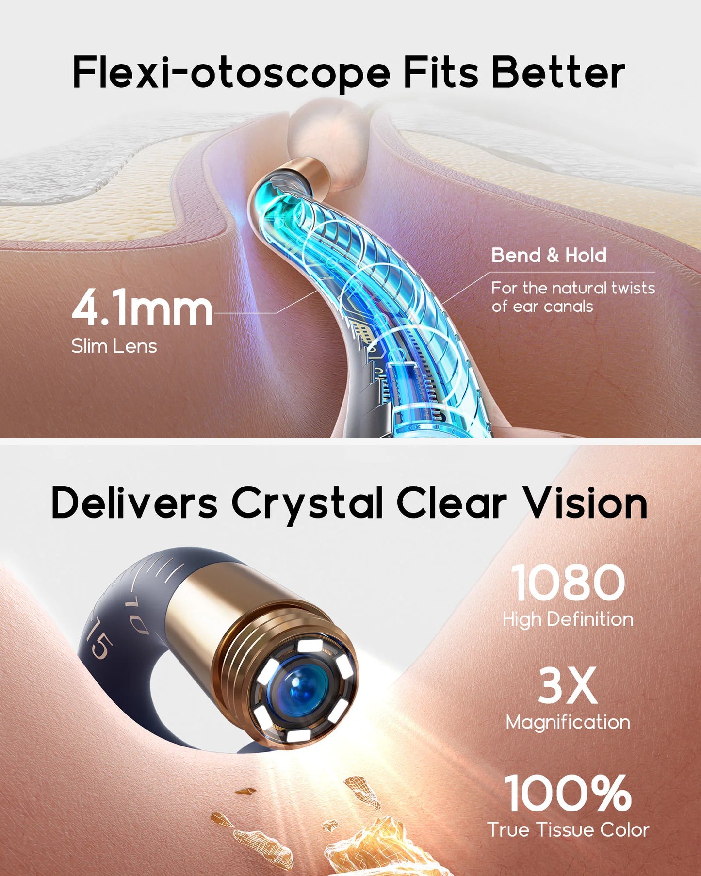Bebird I35R – Nettoyeur d’Oreille Visuel HD Tout-en-1
