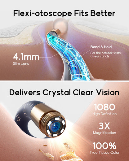 Bebird I35R – Nettoyeur d’Oreille Visuel HD Tout-en-1
